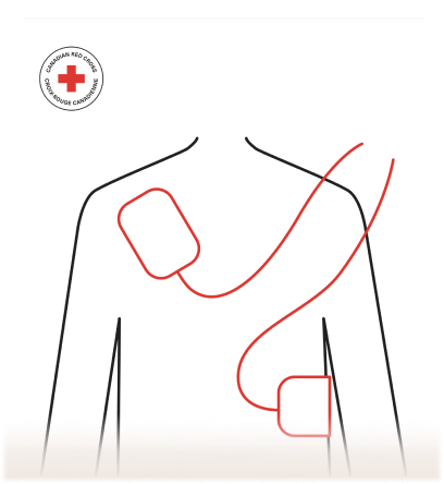 AED - Call, Push, Shock