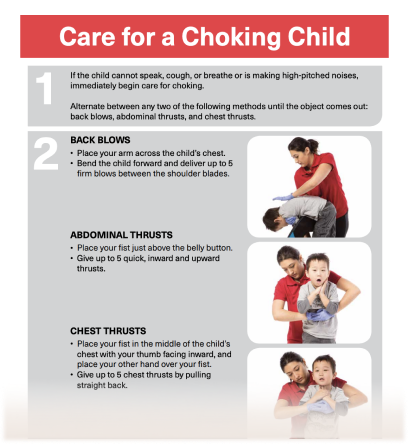 Care for a Choking Child