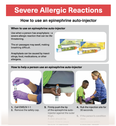 Severe Allergic Reactions Guideline